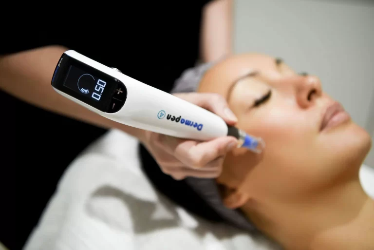 dermapen_microneedling_skin_rejuvenation